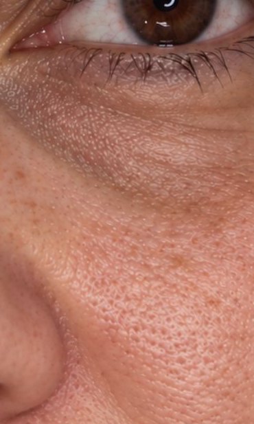 Dull, tired-looking skin