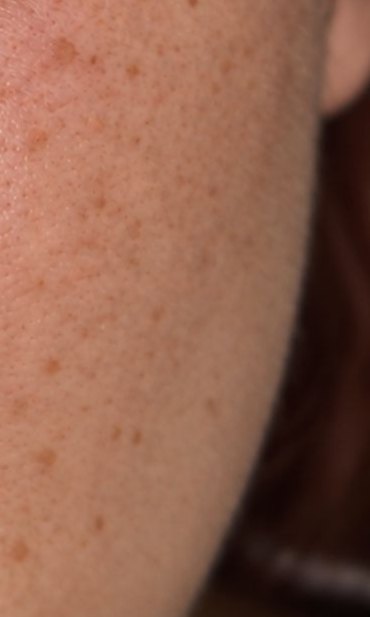 Rough, uneven texture